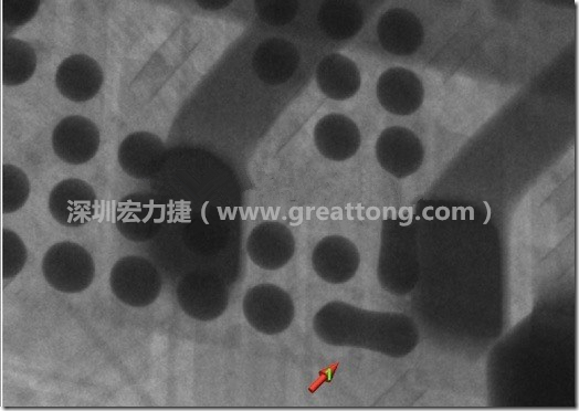 BGA因?yàn)楹笁|變小，造成錫膏過多而最終形成焊接短路的結(jié)果。